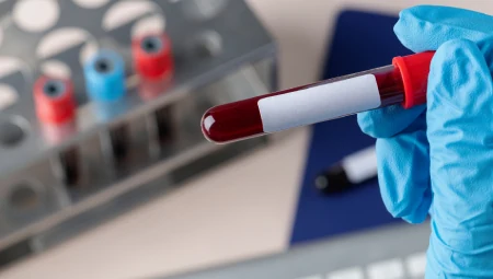 Hematology & Coagulation