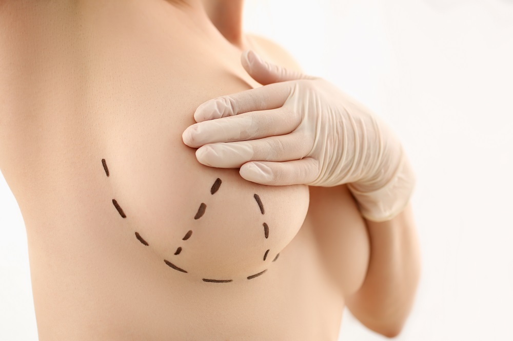 Phẫu thuật thẩm mỹ ngực