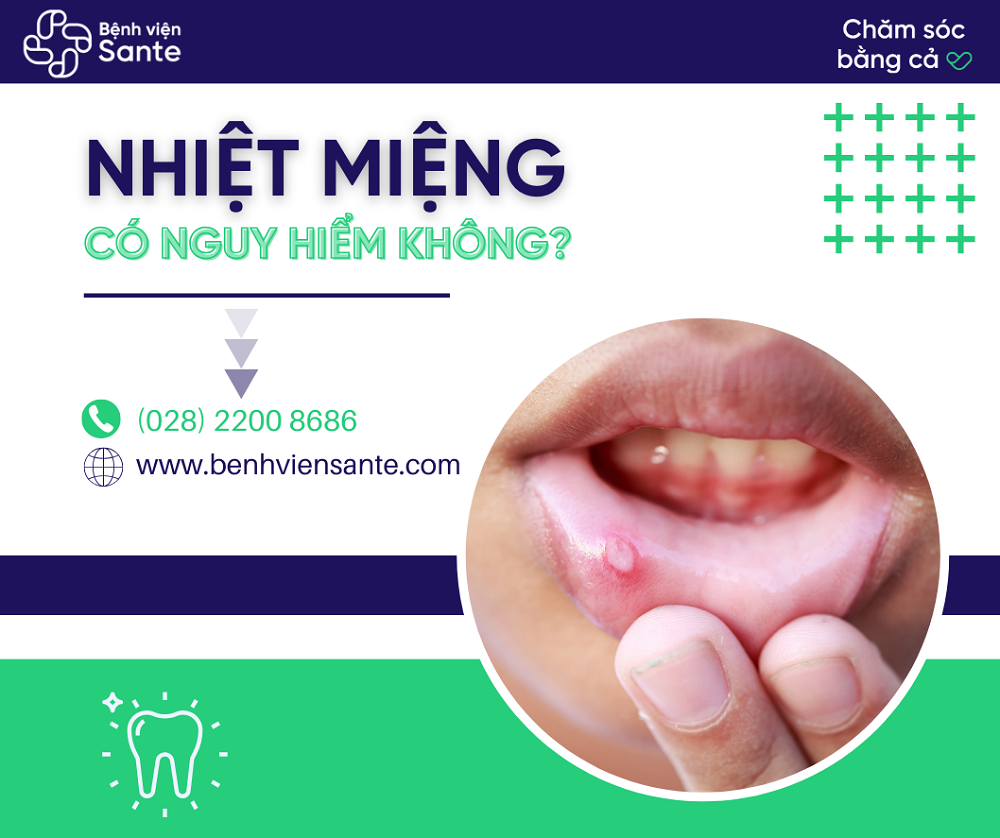 Nhiệt miệng và cách phòng tránh