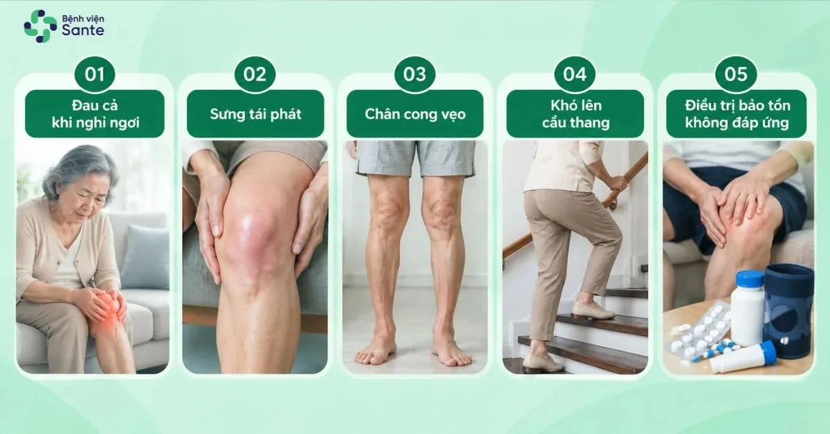 Bệnh viện Sante - Thay Khớp Gối Là Gì? Chỉ Định, Quy Trình & Phục Hồi Sau Mổ (Hình 3) 5 dấu hiệu thoái hóa khớp gối nặng cần thăm khám và đánh giá chỉ định phẫu thuật