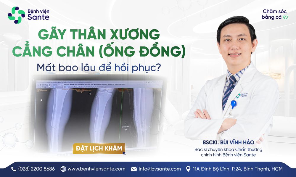 하퇴골(정강이뼈) 골절 회복에는 얼마나 걸릴까요?