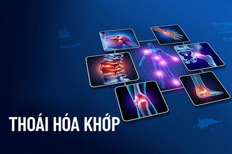 상테 병원 - 퇴행성 관절염 상테 병원 - 퇴행성 관절염