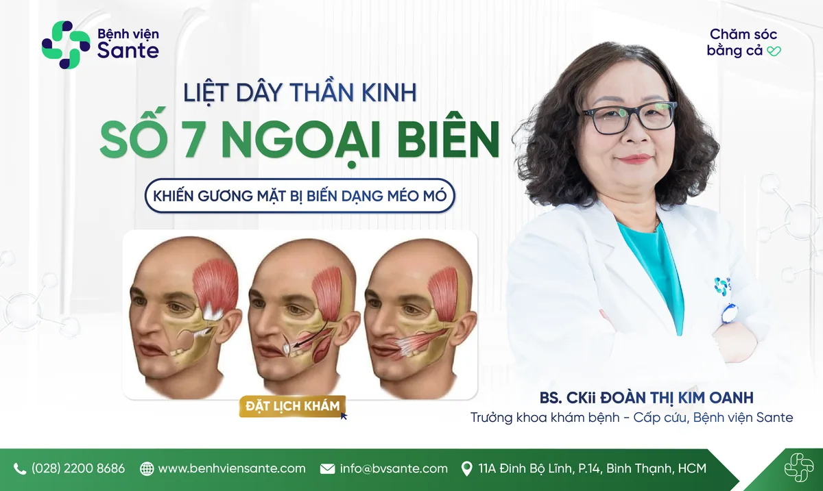 Peripheral facial nerve palsy (Bell's palsy), A CONDITION CAUSING FACIAL ASYMMETRY AND DEFORMITY - SANTE Hospital, Binh Thanh, HCMC Peripheral facial nerve palsy (Bell's palsy), A CONDITION CAUSING FACIAL ASYMMETRY AND DEFORMITY - SANTE Hospital, Binh Thanh, HCMC