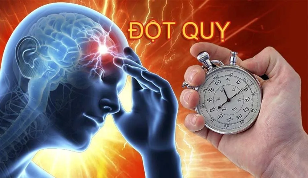 Đột quỵ và Stress: Những câu hỏi thường gặp - Hình 2 - Bệnh viện SANTE Bình Thạnh, TP.HCM Đột quỵ và Stress: Những câu hỏi thường gặp - Hình 2 - Bệnh viện SANTE Bình Thạnh, TP.HCM