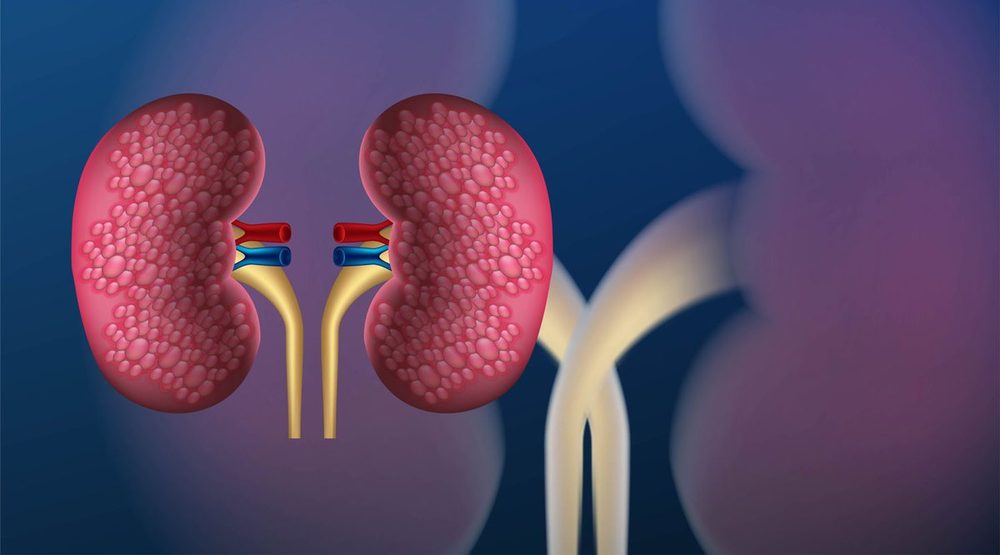 WHAT IS CHRONIC KIDNEY DISEASE? SYMPTOMS, CAUSES, AND EFFECTIVE TREATMENT METHODS