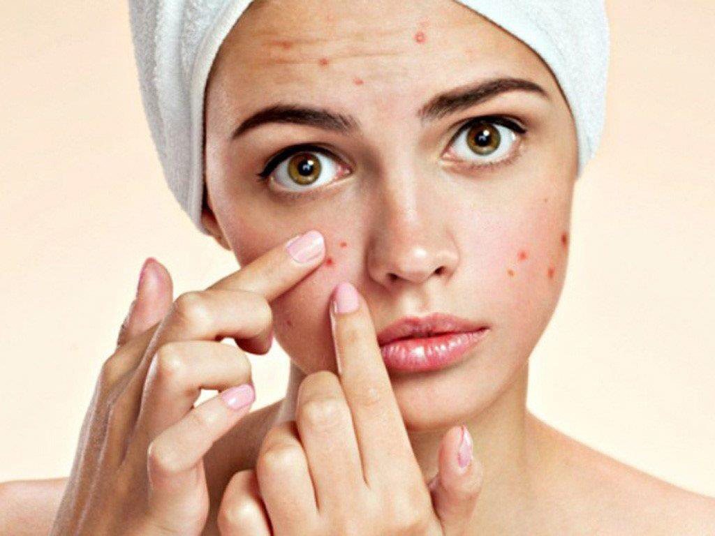 6 effective steps for treating acne scars for bright and smooth skin