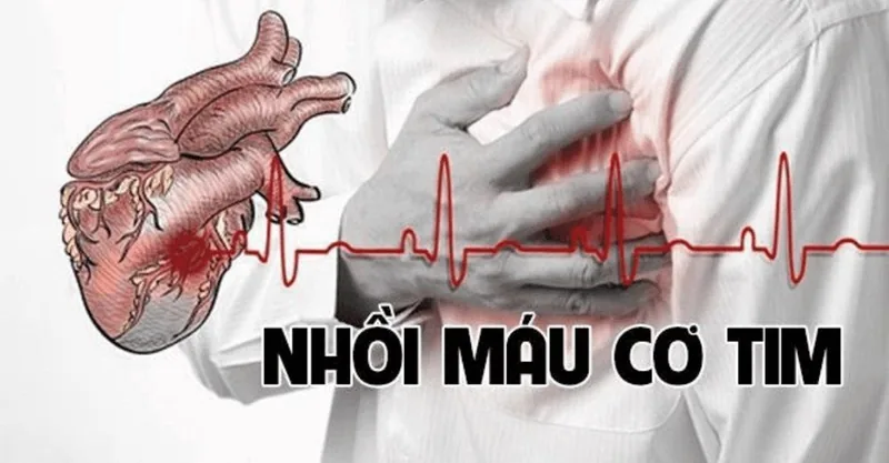 PROTECTING YOUR HEART, SAFEGUARDING YOUR LIFE: PREVENTING MYOCARDIAL INFARCTION