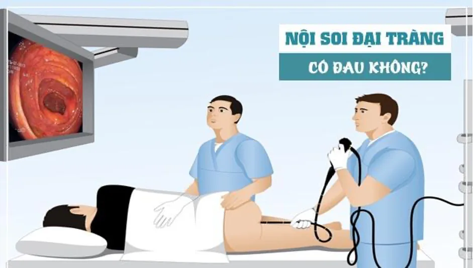 대장암 정밀 선별검사 방법 - 이미지 3 - 산테 병원, 호치민시 빈탄 대장암 정밀 선별검사 방법 - 이미지 3 - 산테 병원, 호치민시 빈탄